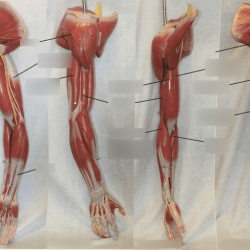 Exercise 12 gross anatomy of the muscular system