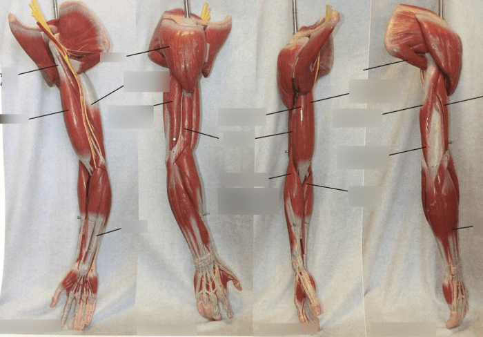 Exercise 12 gross anatomy of the muscular system